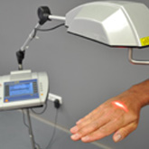 Laserové ošetření pomocí biostimulačního laseru